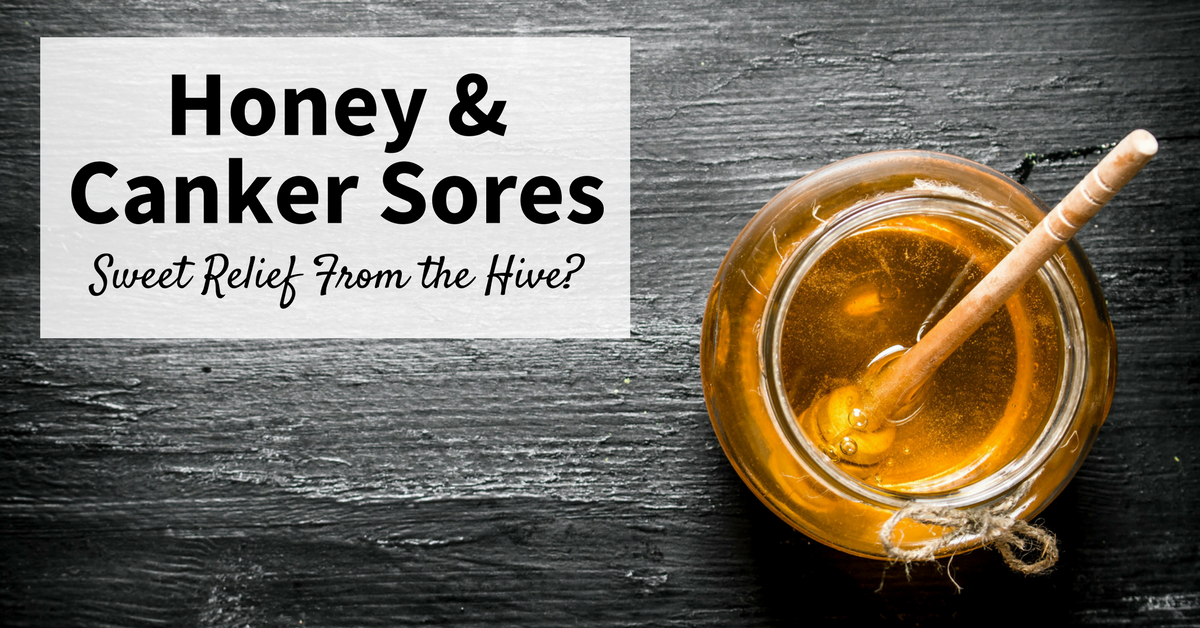 Honey_Canker_Sores_1200x628.png