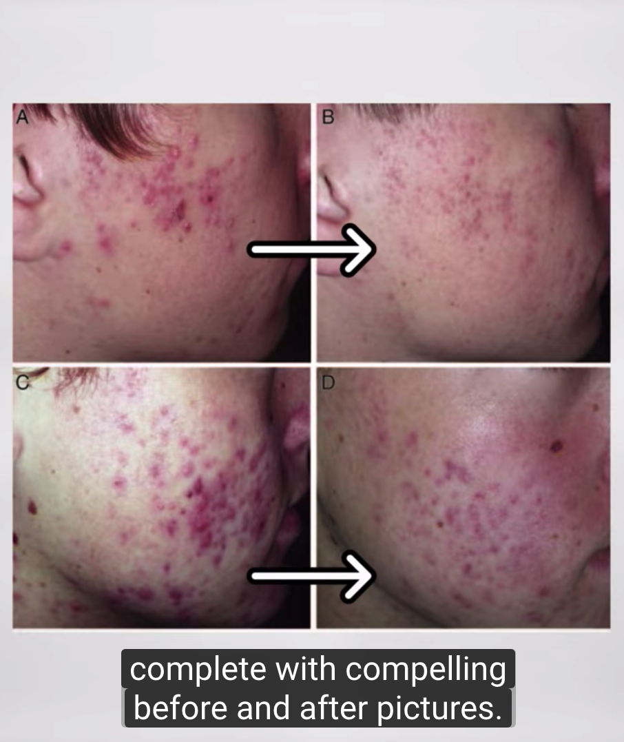 Screenshot 2019-03-17 at 12.22.16 PM (2).png