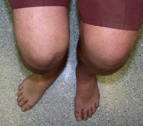 무릎 아픈 당신을 위한 tip4.png