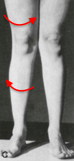 무릎 아픈 당신을 위한 tip3.png