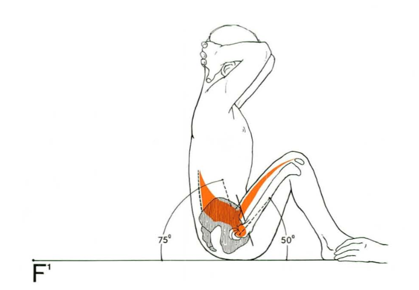 체육시간 윗몸일으키기는 복근운동이 맞을까?4.png