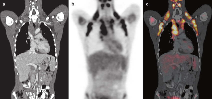 미토콘드리아와 함께_갈색지방.png