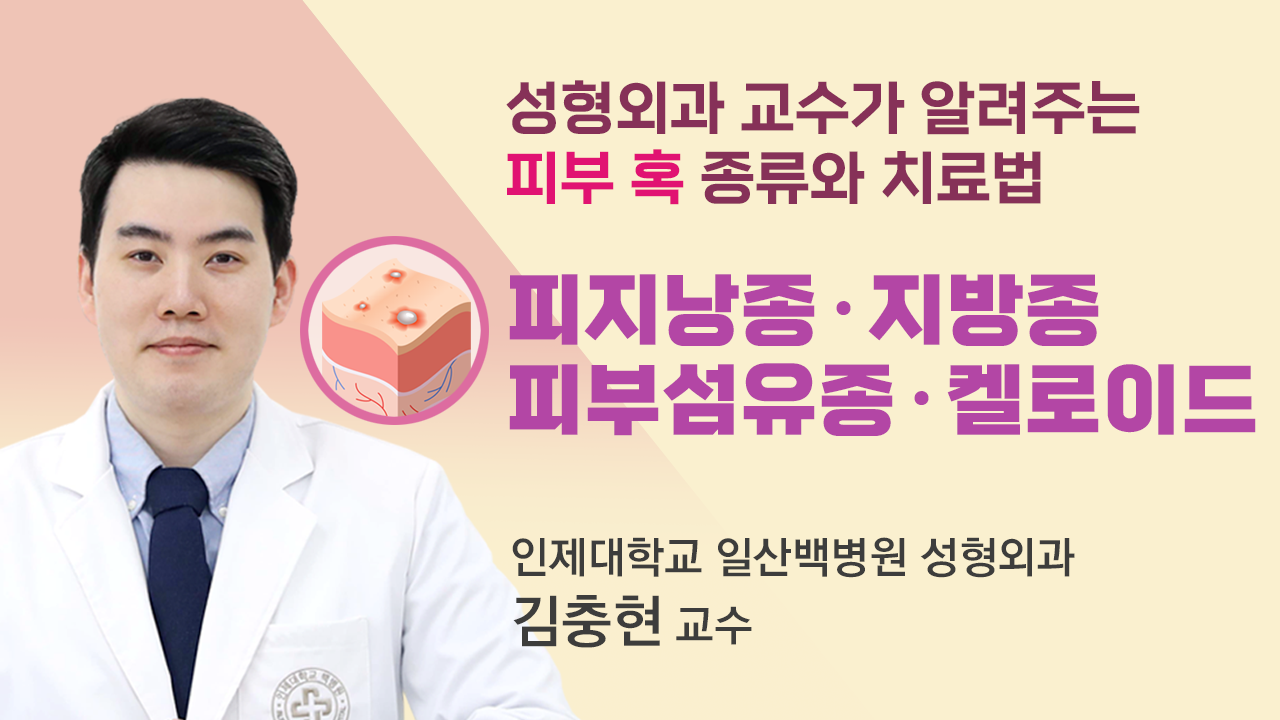 비온 뒤 썸네일_김충현.png