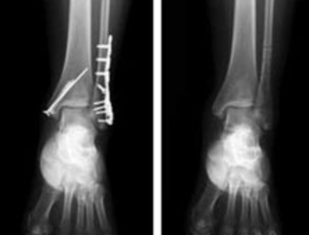 스크린샷 2020-08-05 오후 5.38.07.png