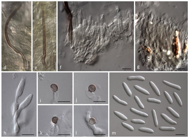 그림-C. humuli 형태적 특징.png