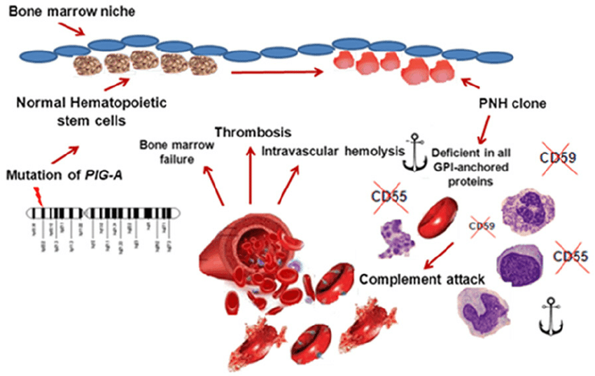 Pathogenesis-of-PNH-A-somatic-acquired-mutation-in-the-gene-encoding-PIG-A-is-the (1).png