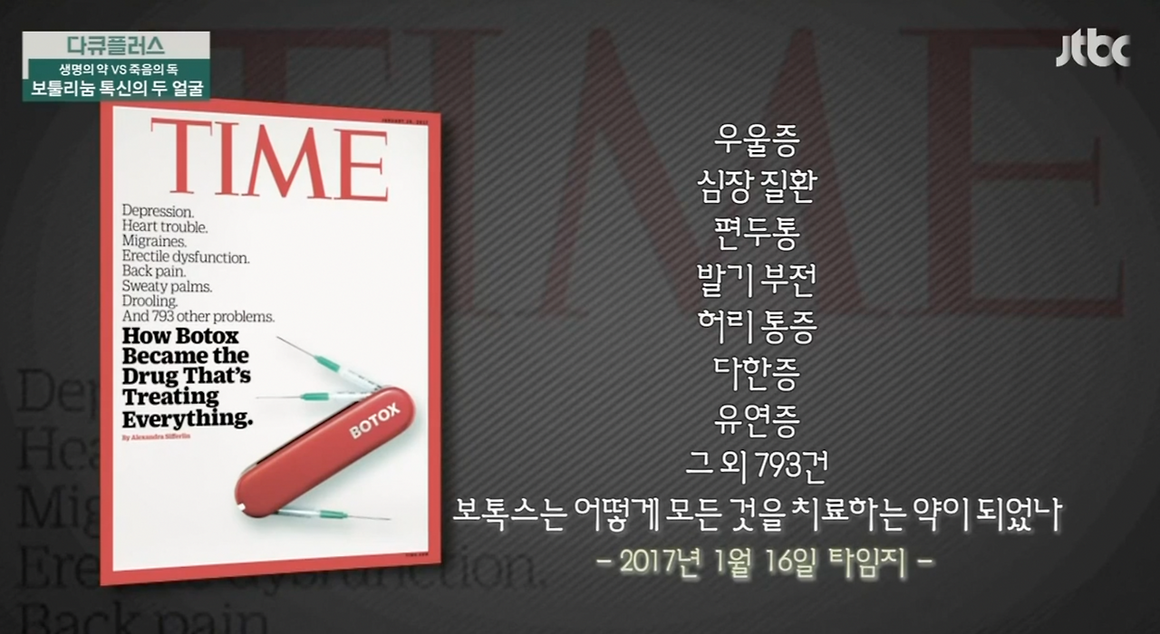 보톡스 치료 양 793건 .png