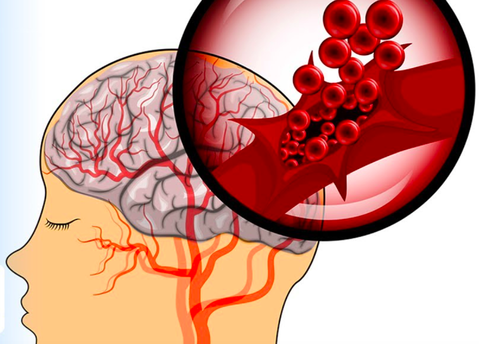 스크린샷 2018-05-27 오후 7.57.46.png