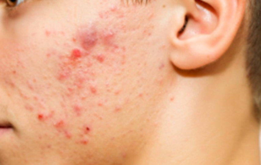 스크린샷 2018-05-28 오전 11.51.30.png