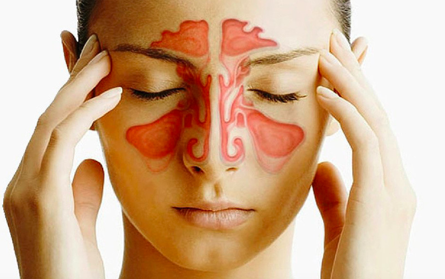 스크린샷 2018-05-28 오전 11.57.32.png