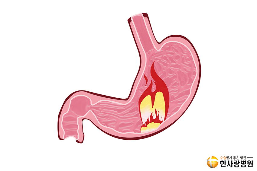 담낭염증상 이미지 (3).png