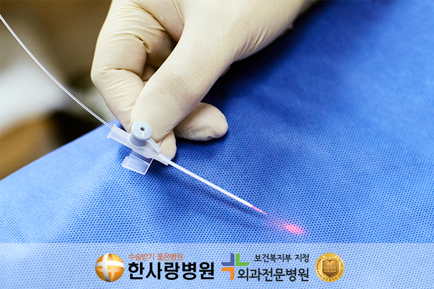 하지정맥류수술 (4).png