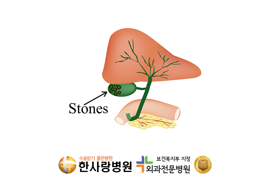 쓸개에돌 (2).png