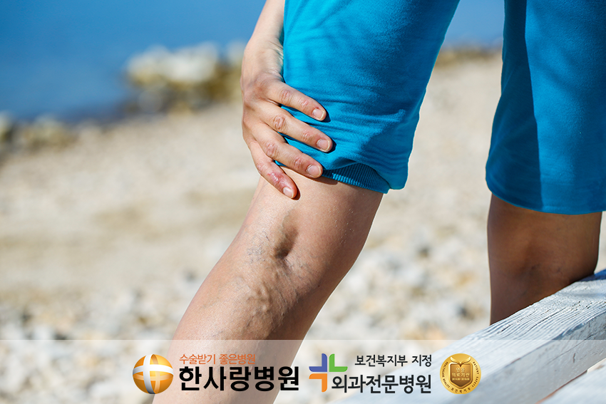 하지정맥류 (5).png