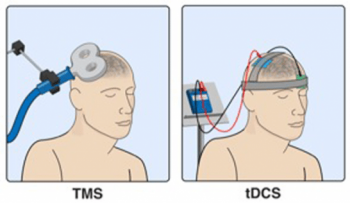 TMS-vs-tDCS-simple-graphic1-350x203.png