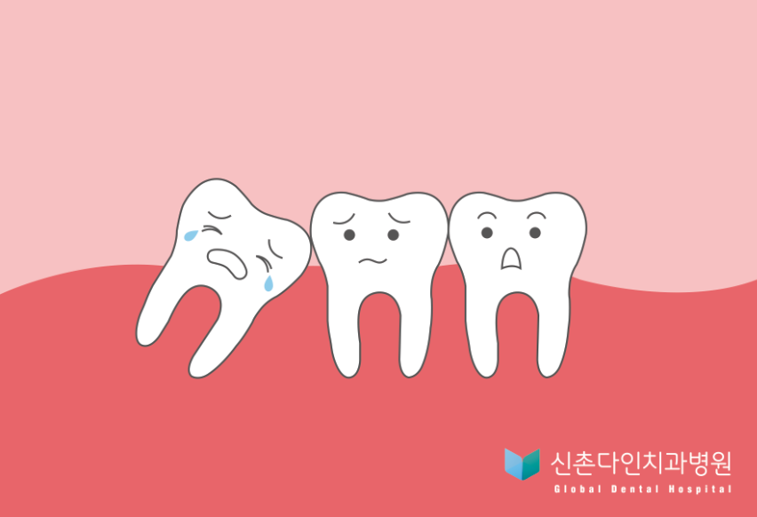 사랑니 치아_1++.png