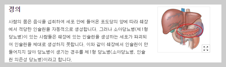 제 1형 당뇨병.png