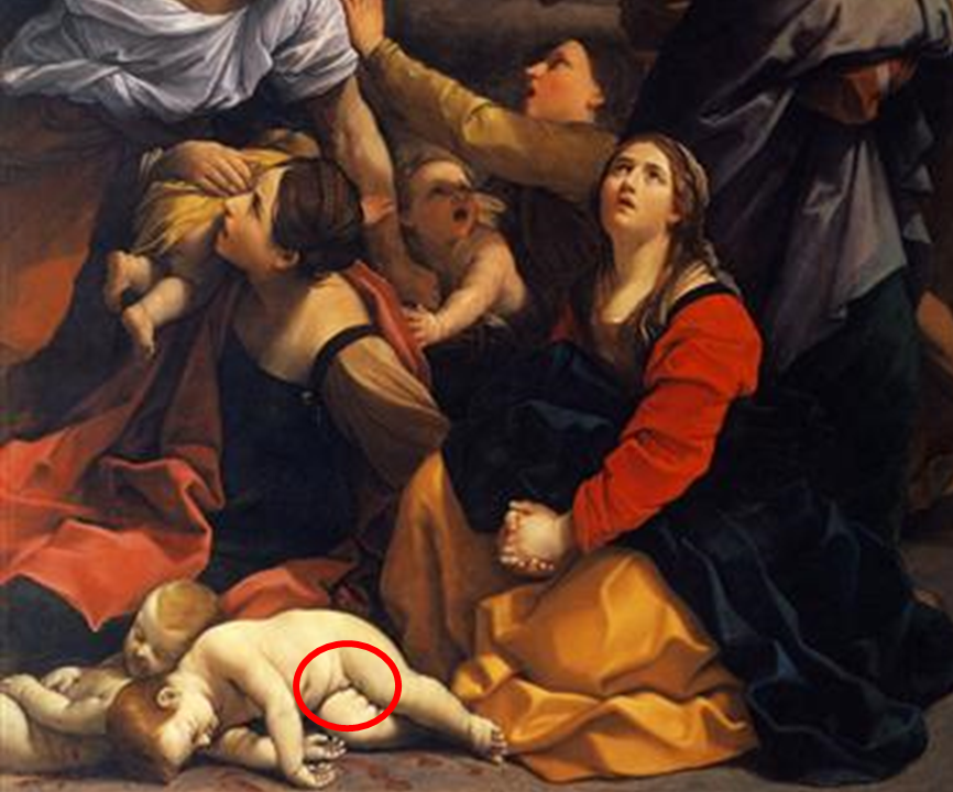 영아 살해 귀도레니fv6.png