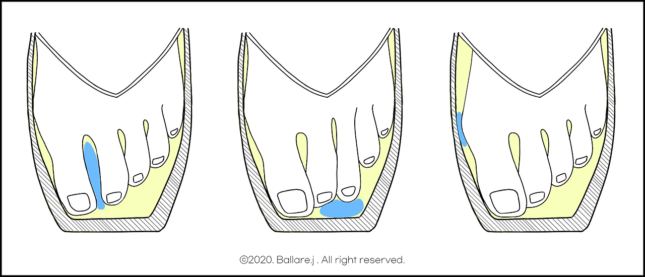 미니토패드 예시.png