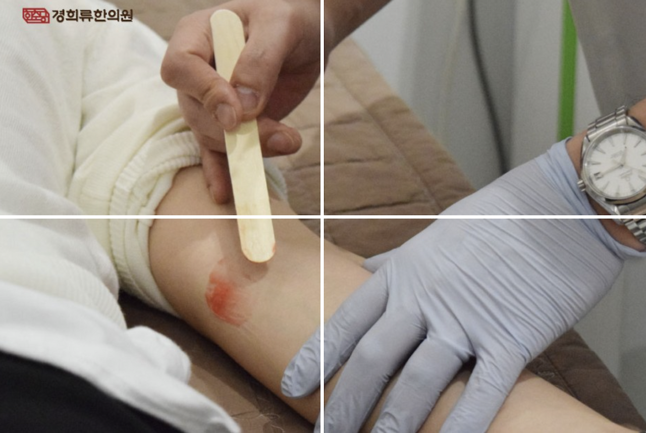 스크린샷 2023-11-22 오후 6.36.54.png