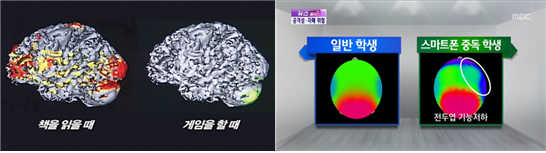 팝콘 브레인.png