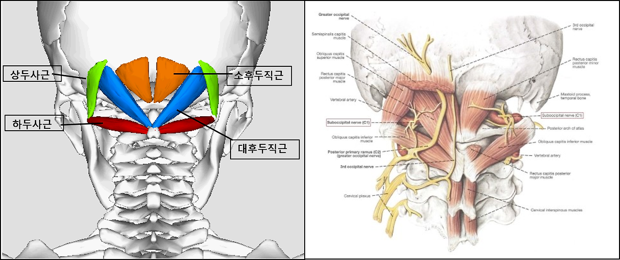 뒷머리 통증(왼쪽 오른쪽), 후두하근 11