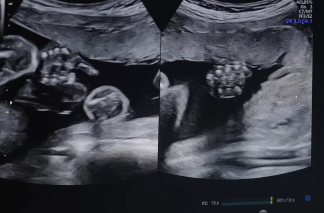 Screenshot 2025-04-12 at 23.03.31.png