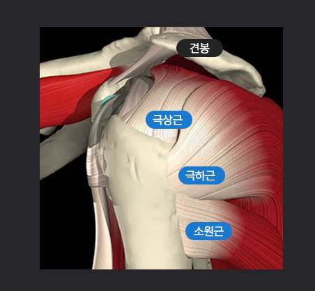 회전근개파열.png