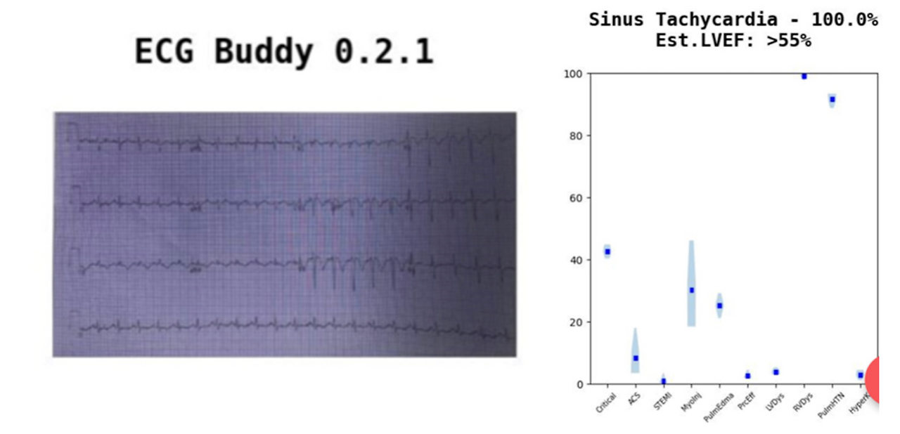 사진3. 알피 예시.png