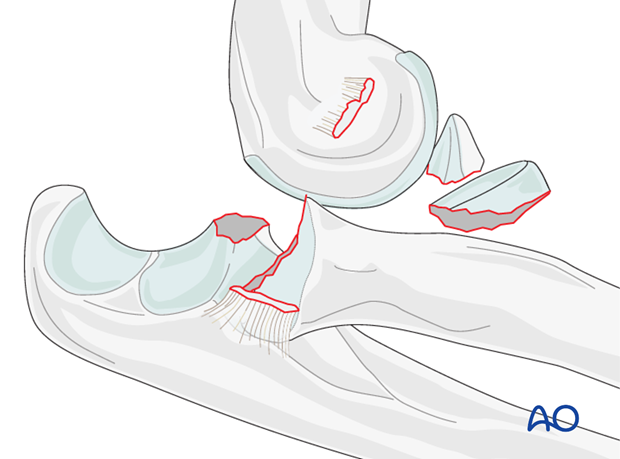 21_P413_i000 (1).png