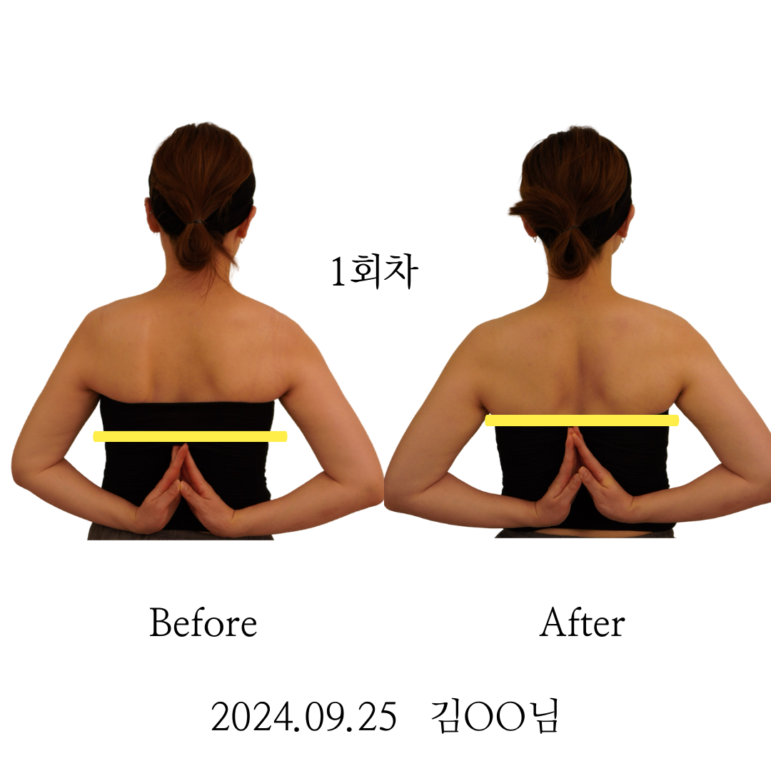 청담동 필라테스_ 승모클리닉 1.png