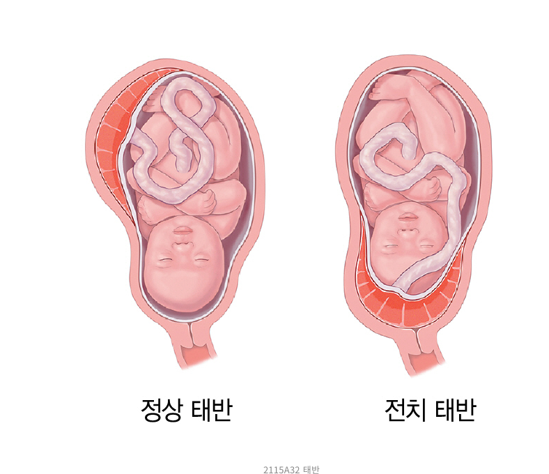 스크린샷 2022-01-09 오전 11.41.53.png