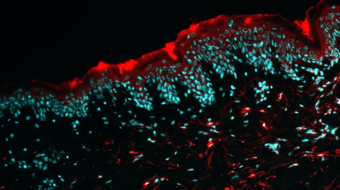 Alys Pharma siRNA.png