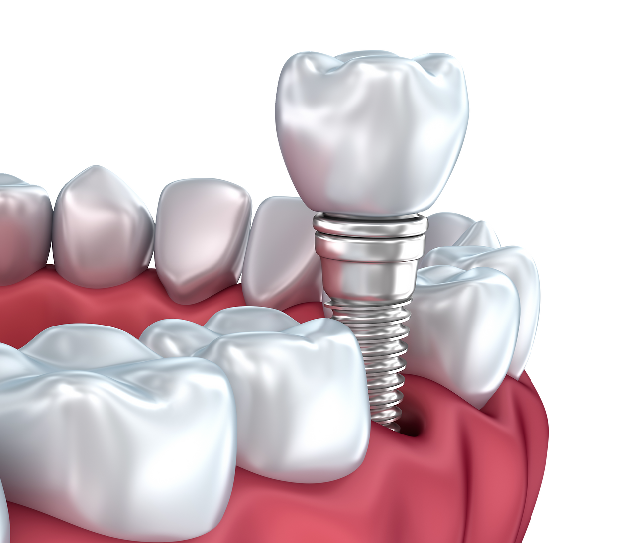 AdobeStock_136018845 copy.png