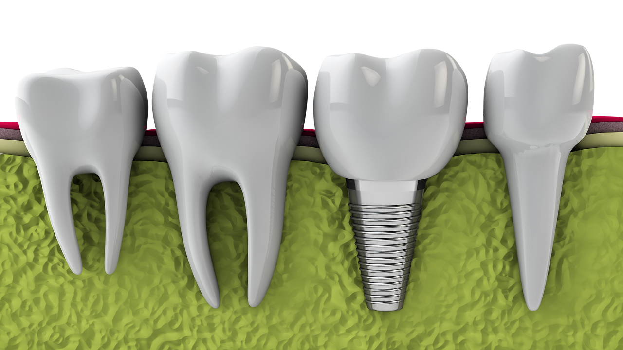 29507870_xxl copy.png