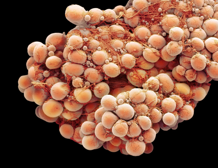 20260126 _ 갈색지방, 혈압 낮추는 새 단서… _ 2-1.png