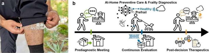 20260113 _ 노인 허약, AI 메쉬 슬리브로 조기 감지한다 _ 2-1.png