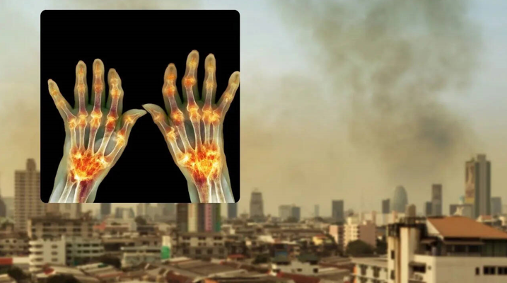 20251229 _ 대기오염 PM2.5, 루푸스·관절염 위험 신호 _ 2.png