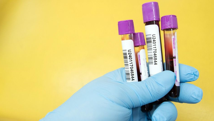 20260120 _ 크론병 혈액검사, 증상 전 2~3년 예측 가능 _ 2.png