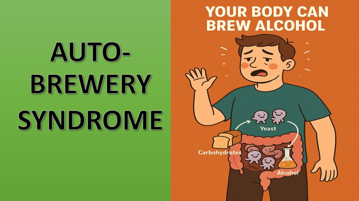 20260123 _ 자가양조증후군, 술 없이 취하는 이유 _ 2.png