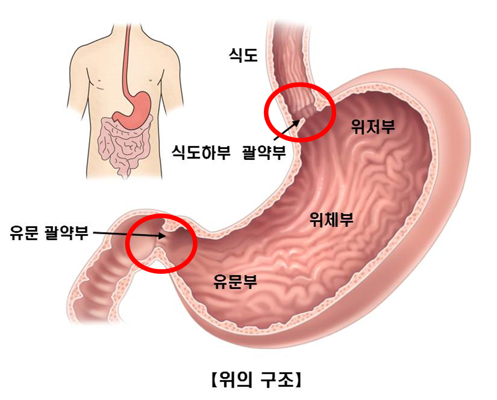 내시경 힘든 곳.png