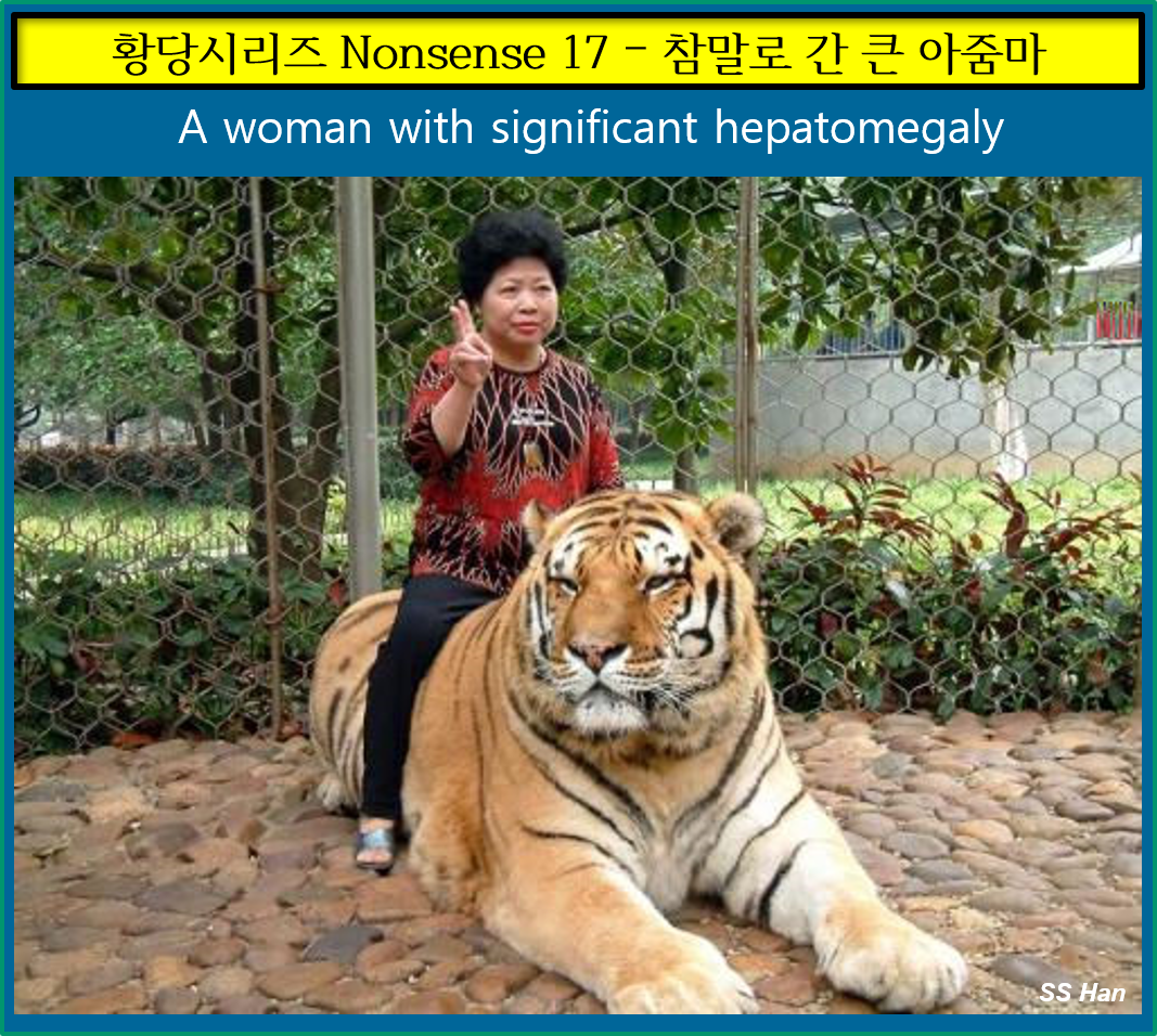 황당 17 간큰 아줌마.png