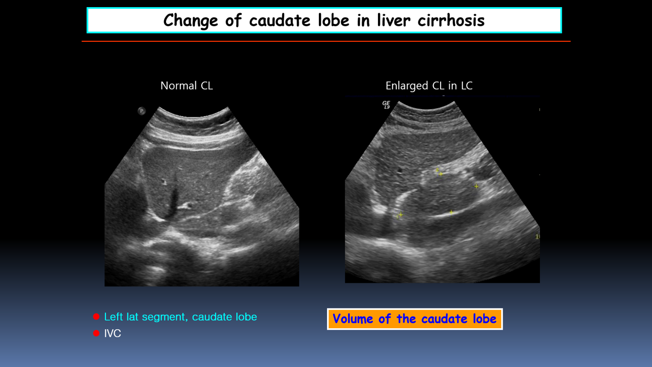 검은배경 밝은 여백 2.png