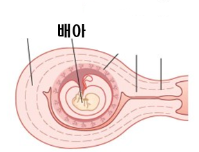 임신 7주 배아2.png