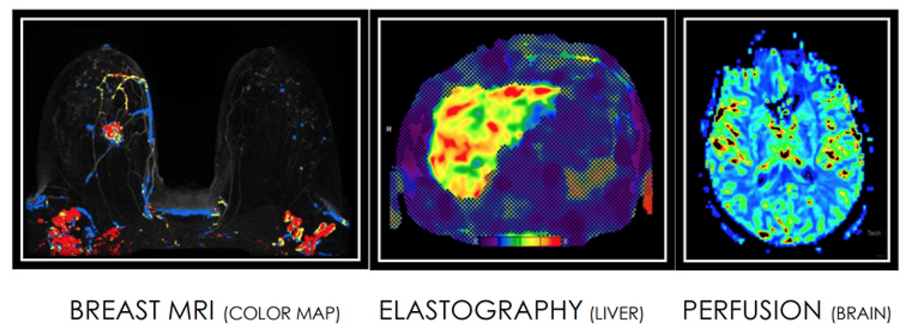 Screen Shot 2022-09-03 at 3.23.15 PM.png