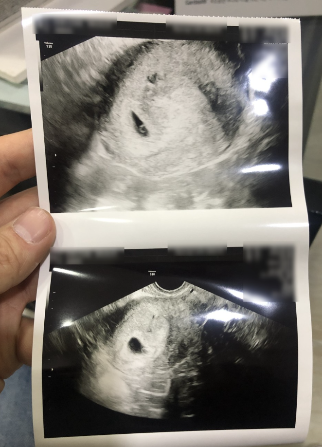 스크린샷 2022-10-17 오전 10.49.32.png