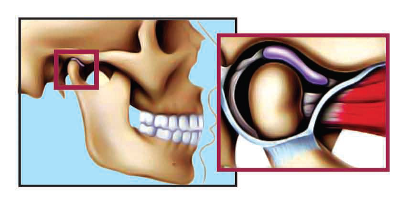 temporomandibular-joint-disorder-normal-closed-position-national-dental-centre-singapore.png