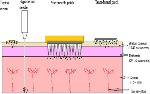 마이크로니들 피부.png