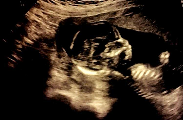 엄마의 바다.png