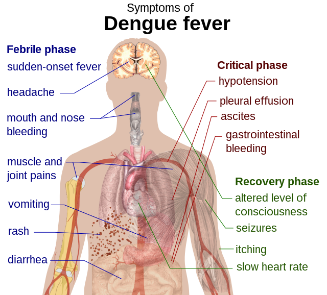 Dengue_fever_symptoms.svg.png